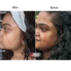 The Inkey List 15 Vitamin C And EGF Serum before after