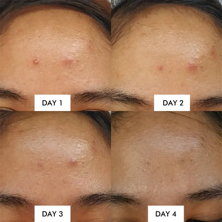 SOME BY MI AHA-BHA-PHA 14 Days Super Miracle Spot All Kill Cream, 30ml