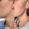 Good Molecules 10% Niacinamide Serum, 30 ml 6 Good Molecules 10 Niacinamide Serum 30 ml 1