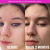 Good Molecules 10% Niacinamide Serum, 30 ml 7 Good Molecules 10 Niacinamide Serum 30 ml 2