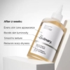 The Ordinary Glycolic Acid 7% Exfoliating Toner, 100 ml 5 The Ordinary Glycolic Acid 7 Toning Solution 1