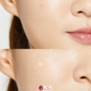 Cosrx Pimple Patch 8 Cosrx Pimple Patch 4