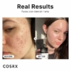 Cosrx 15% Niacinamide Serum, 20 ml 7 Cosrx 15 Niacinamide Serum 1