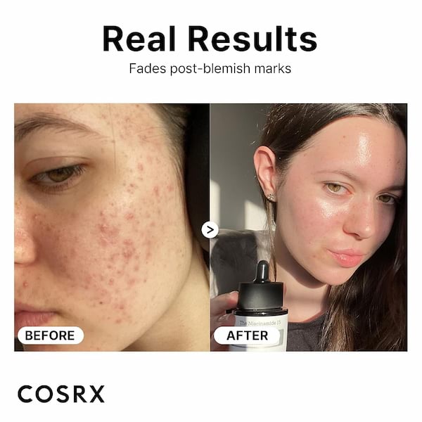 Cosrx 15% Niacinamide Serum, 20 ml 2 Cosrx 15% Niacinamide Serum, 20 ml - Image 2