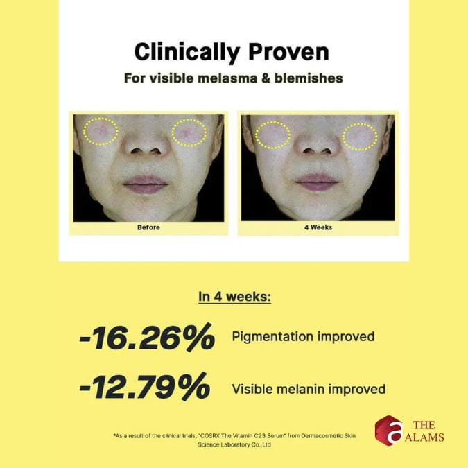 Cosrx 23% Vitamin C Serum, 20 g 4 Cosrx 23% Vitamin C Serum, 20 g - Image 4