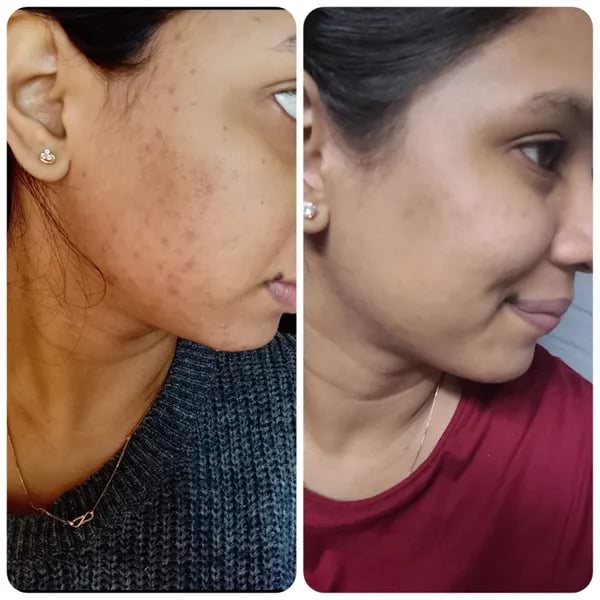 Minimalist 10% Niacinamide Serum, 30 ml 2 Minimalist 10% Niacinamide Serum, 30 ml - Image 2