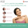 Lacto Calamine Face Lotion For Combination To Normal Skin, 120 ml 6 Lacto Calamine Face Lotion For Combination To Normal Skin 120 ml 1