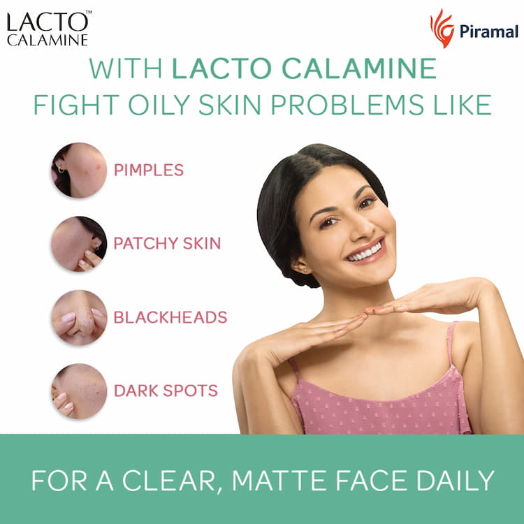 Lacto Calamine Face Lotion For Combination To Normal Skin, 120 ml 2 Lacto Calamine Face Lotion For Combination To Normal Skin, 120 ml - Image 2