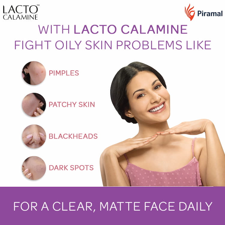 Lacto Calamine Face Lotion For Oily Skin, 115 ml 2 Lacto Calamine Face Lotion For Oily Skin, 115 ml - Image 2