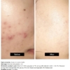 Minimalist 10% Vitamin C Serum, 30 ml 8 Minimalist 10 Vitamin C Serum 30 ml 1