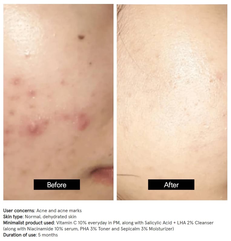 Minimalist 10% Vitamin C Serum, 30 ml 2 Minimalist 10% Vitamin C Serum, 30 ml - Image 2