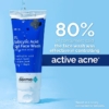 The Derma Co. 1% Salicylic Acid Gel Daily Face Wash For Acne, 100 ml 7 The Derma Co. 1 Salicylic Acid Gel Daily Face Wash For Acne 100 ml 1