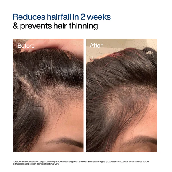 WishCare Hair Growth Serum Concentrate, 30 ml 2 WishCare Hair Growth Serum Concentrate, 30 ml - Image 2