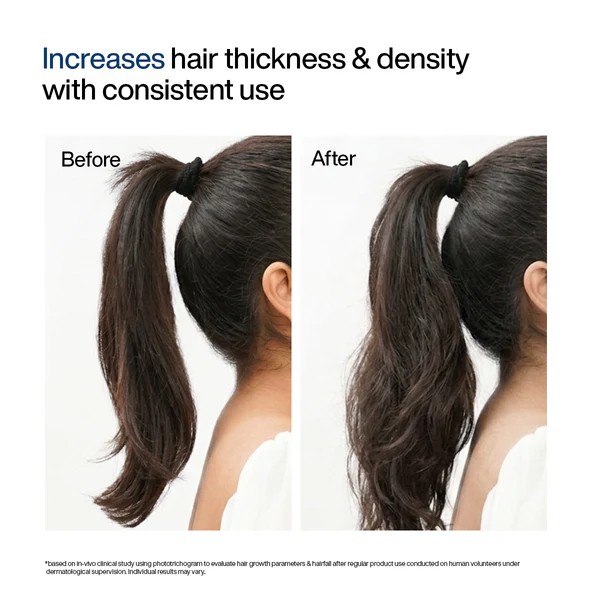 WishCare Hair Growth Serum Concentrate, 30 ml 4 WishCare Hair Growth Serum Concentrate, 30 ml - Image 4