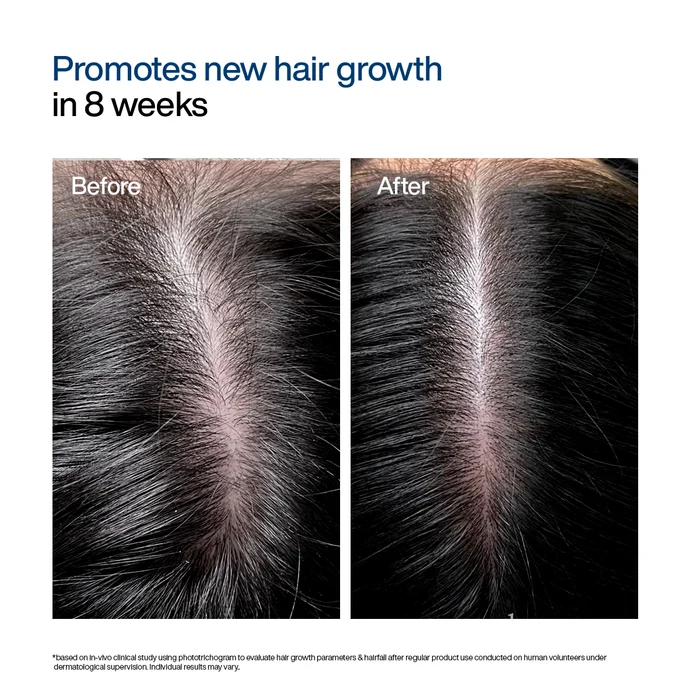 WishCare Hair Growth Serum Concentrate, 30 ml 6 WishCare Hair Growth Serum Concentrate, 30 ml - Image 6