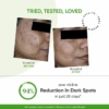 Dot & Key 10% Niacinamide + Cica Serum With Alpha Arbutin For Dark Spots, 30 ml 8 Dot & Key 10% Niacinamide + Cica Serum With Alpha Arbutin For Dark Spots, 30 ml