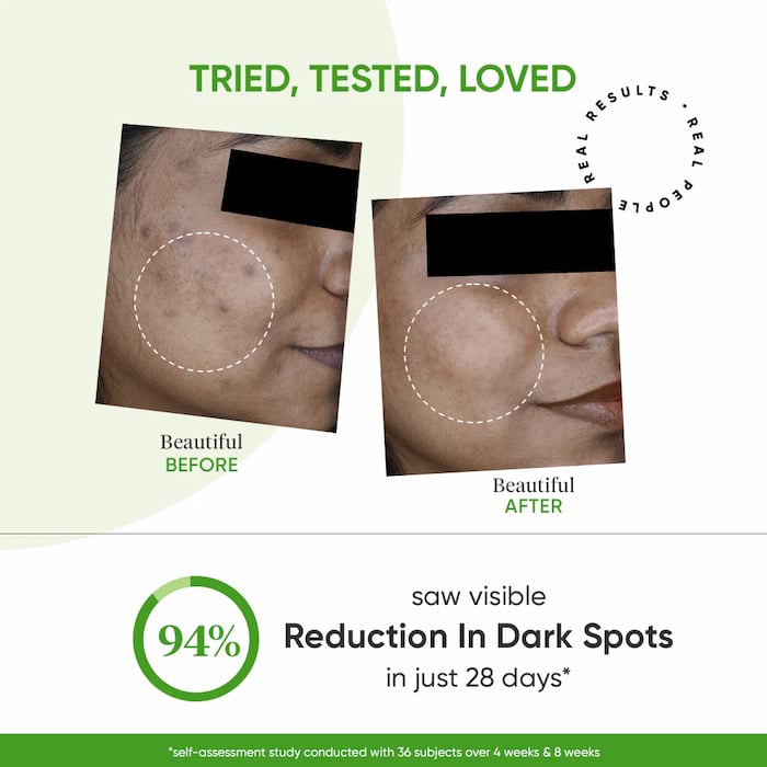Dot & Key 10% Niacinamide + Cica Serum With Alpha Arbutin For Dark Spots, 30 ml 3 Dot & Key 10% Niacinamide + Cica Serum With Alpha Arbutin For Dark Spots, 30 ml