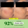Dot & Key Cica Calming Oil Free Moisturizer For Acne Prone Skin, 60 ml 8 Dot & Key Cica Niacinamide Oil Free Moisturizer, 60 ml