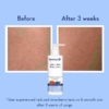 WishCare AHA + BHA Body Lotion For Bumpy Pigmented Skin, 200 ml 9 WishCare AHA BHA Body Lotion For Bumpy Pigmented Skin 200 ml 2