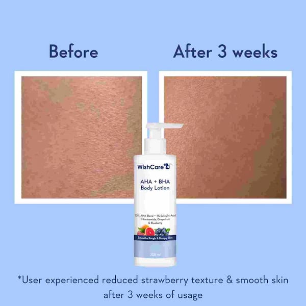 WishCare AHA + BHA Body Lotion For Bumpy Pigmented Skin, 200 ml 3 WishCare AHA + BHA Body Lotion For Bumpy Pigmented Skin, 200 ml - Image 3