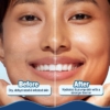 Aqualogica 5 Barrier + Hydra Gel Moisturizer For Dry Skin, 200 g 8 Aqualogica 5 Barrier Hydra Gel Moisturizer 2 1
