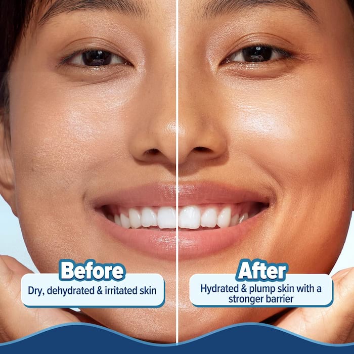 Aqualogica 5 Barrier + Hydra Gel Moisturizer For Dry Skin, 200 g 3 Aqualogica 5 Barrier + Hydra Gel Moisturizer For Dry Skin, 200 g - Image 3
