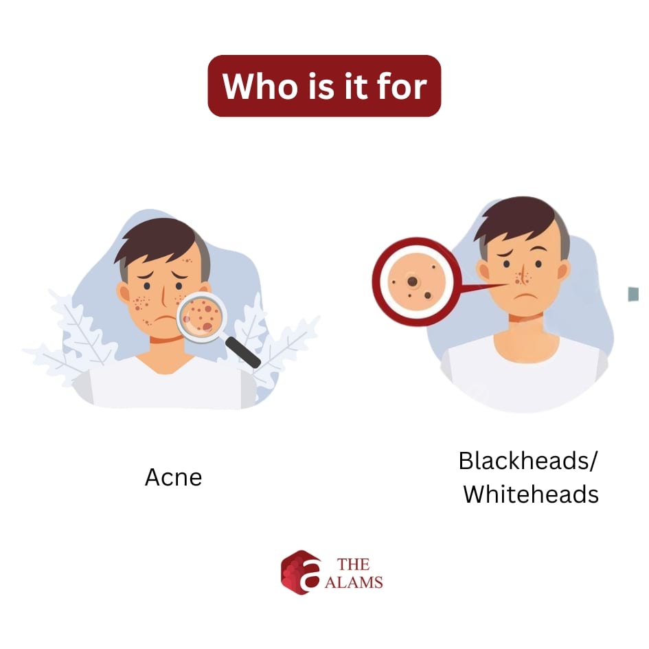 PanOxyl Acne Creamy Face & Body Wash With 4% Benzoyl Peroxide, 170 g 2 PanOxyl Acne Creamy Face & Body Wash With 4% Benzoyl Peroxide, 170 g - Image 2