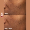 Paula's Choice 6% Mandelic Acid + 2% Lactic Acid Liquid Exfoliant, 30 ml 8 Paulas Choice 6 Lactic Acid Liquid Exfoliant 1