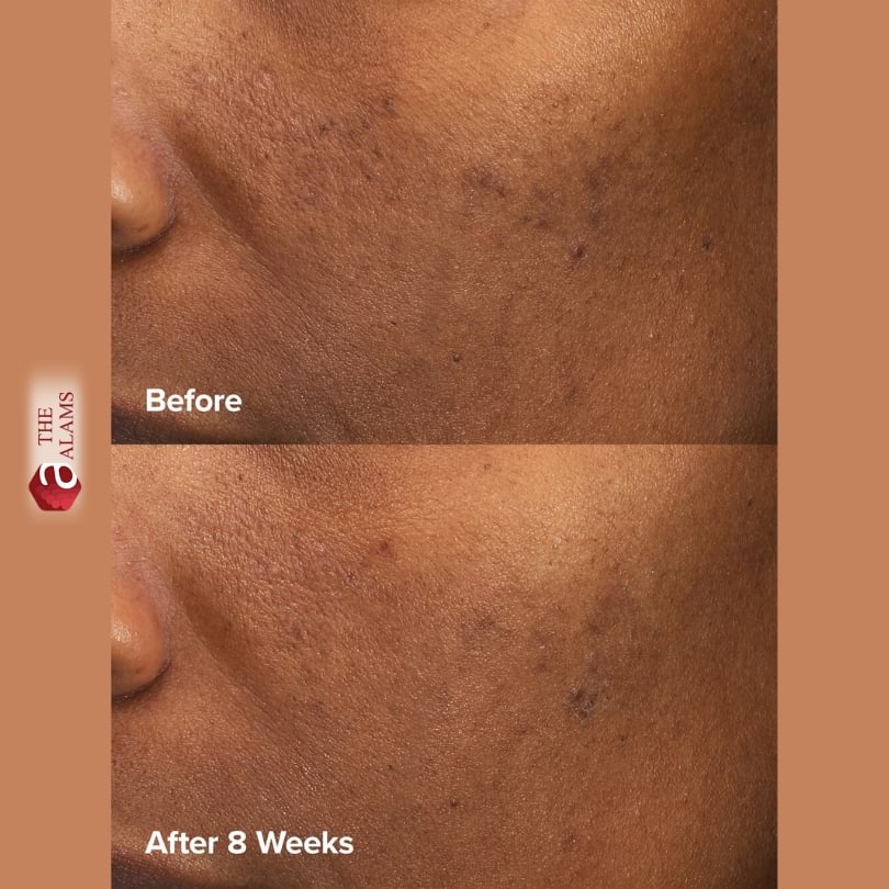 Paula's Choice 6% Mandelic Acid + 2% Lactic Acid Liquid Exfoliant, 30 ml 2 Paula's Choice 6% Mandelic Acid + 2% Lactic Acid Liquid Exfoliant, 30 ml - Image 2
