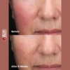 Paula's Choice 6% Mandelic Acid + 2% Lactic Acid Liquid Exfoliant, 30 ml 9 Paulas Choice 6 Lactic Acid Liquid Exfoliant 2 1