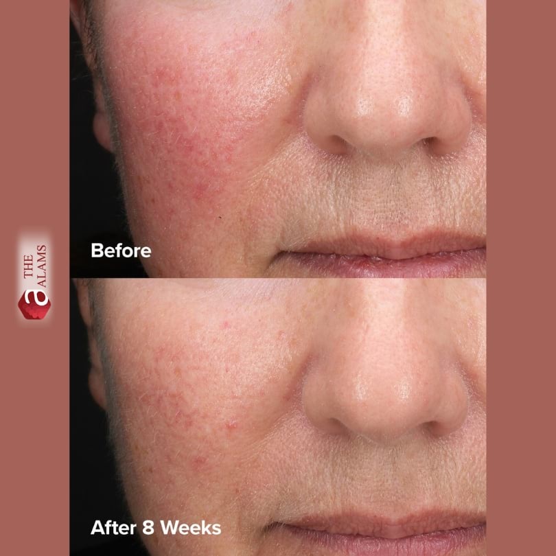 Paula's Choice 6% Mandelic Acid + 2% Lactic Acid Liquid Exfoliant, 30 ml 3 Paula's Choice 6% Mandelic Acid + 2% Lactic Acid Liquid Exfoliant, 30 ml - Image 3