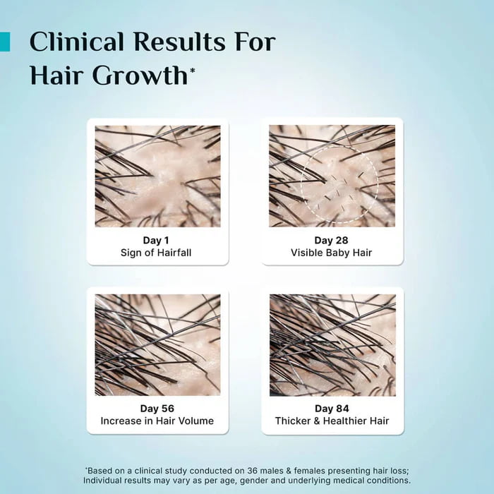 Pilgrim Redensyl And Anagain Advanced Hair Growth Serum, 50 ml 4 Pilgrim Redensyl And Anagain Advanced Hair Growth Serum, 50 ml - Image 4