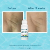 Wishcare Under Arm Roll On Serum For Dark Underarms, 50 ml 7 Wishcare Under Arm Roll On Serum 50 ml 1