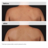 The Ordinary Salicylic Acid 0.5% Body Serum, 240 ml 5 The Ordinary Salicylic Acid 0.5 Body Serum 1