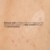 The Ordinary Salicylic Acid 0.5% Body Serum, 240 ml 7 The Ordinary Salicylic Acid 0.5 Body Serum 3