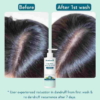 Wishcare AHA BHA Anti Dandruff Shampoo, 250 ml 6 Wishcare AHA BHA Anti Dandruff Shampoo 250 ml 1