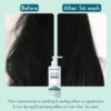 WishCare Ceramide Anti Dandruff Conditioner, 200 ml 7 WishCare Ceramide Anti Dandruff Conditioner Gallery Image 800x800 1