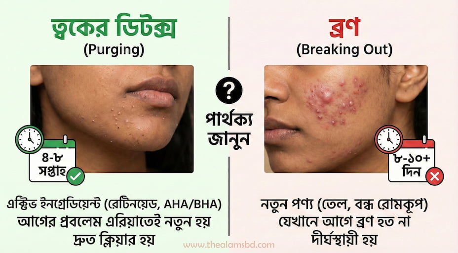স্কিনকেয়ার প্রোডাক্ট ব্যবহারের পর ব্রণ? 'Purging' নাকি 'Breakout'? 2 Purging 1 blog