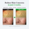Dr Althea Gentle Vitamin C Serum 800x800 002