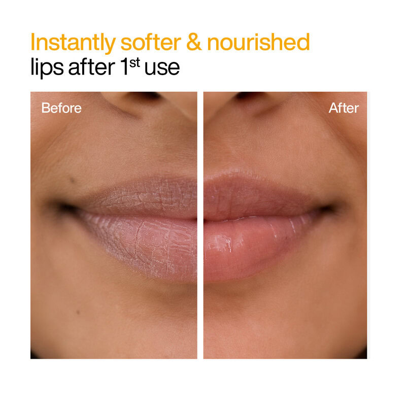 WishCare Ceramide Natural Lip Balm SPF 50 PA+++, 5 g 2 WishCare Ceramide Natural Lip Balm SPF 50 PA+++, 5 g - Image 2
